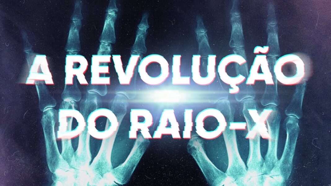 A Revolução do Raio X A Revolução do Raio X
