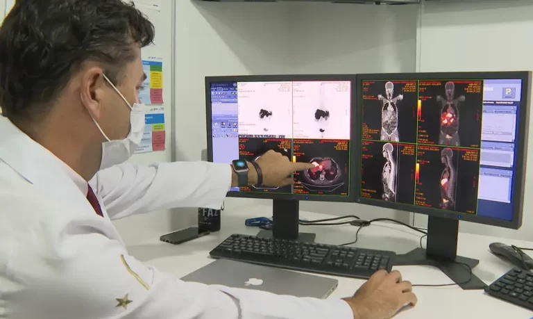 Estudo identifica principal fator de câncer de cólon entre jovens