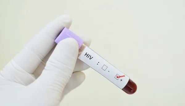 OMS reconhece o fim da transmissão do HIV de mãe para filho no Brasil OMS reconhece o fim da transmissão do HIV de mãe para filho no Brasil