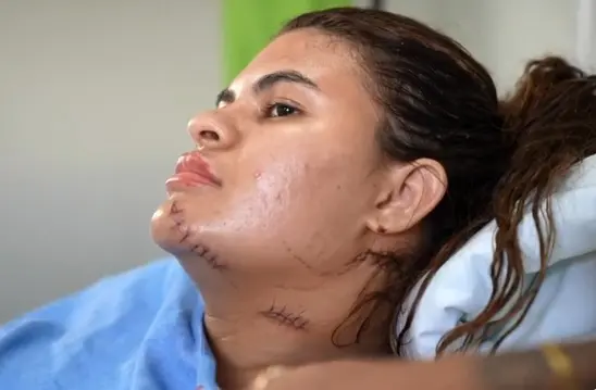 ‘Me fiz de morta’, mulher teve mãos amputadas com foice ‘Me fiz de morta’, mulher teve mãos amputadas com foice