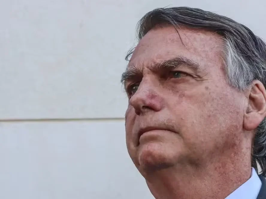 Bolsonaro alta de hospital e volta domiciliar após cirurgia Bolsonaro alta de hospital e volta domiciliar após cirurgia