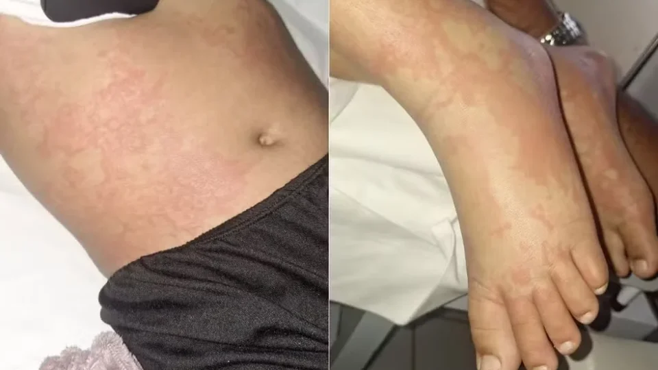 Exame descarta contaminação de detergente; criança internada Exame descarta contaminação de detergente; criança internada