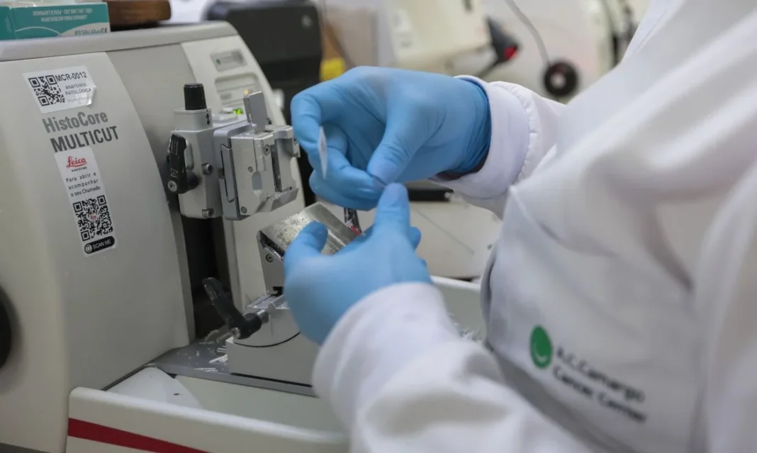 SUS inclui nova terapia para pacientes adultos com leucemia mieloide SUS inclui nova terapia para pacientes adultos com leucemia mieloide