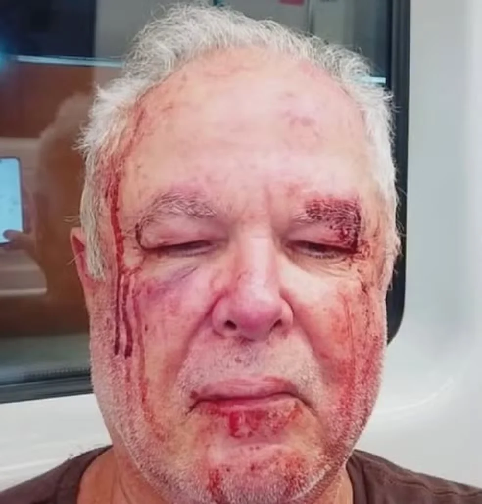 Polícia investiga agressão a idoso por motivação política em Copacabana (RJ) Polícia investiga agressão a idoso por motivação política em Copacabana (RJ)
