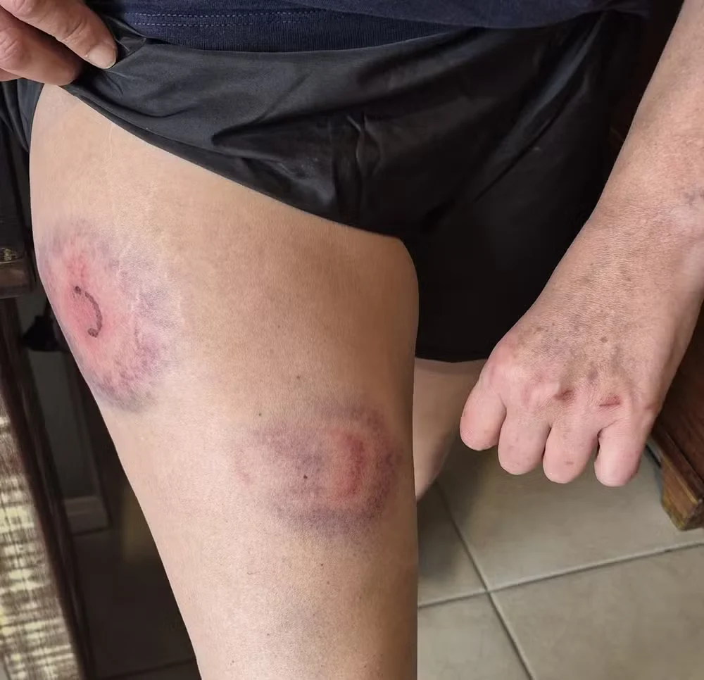 Suplente do PT ao Senado leva tiros de borracha durante ação da Polícia Militar em SC Suplente do PT ao Senado leva tiros de borracha durante ação da Polícia Militar em SC