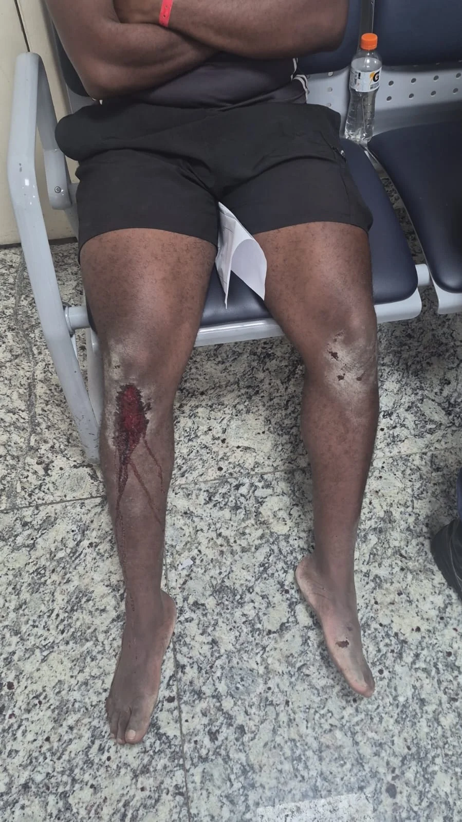Jovem diz ter sido espancado por bolsonaristas antes de ato pró-Lula no Rio Jovem diz ter sido espancado por bolsonaristas antes de ato pró-Lula no Rio